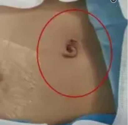 赤峰市小兒外科醫(yī)院電話號(hào)碼-第1張圖片