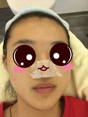 赤峰清潔黑頭團購電話地址是多少-第1張圖片