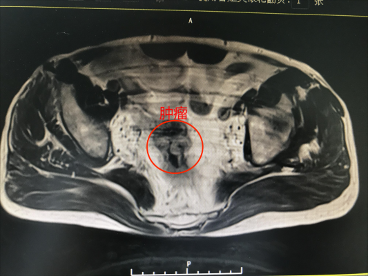 赤峰市醫(yī)院肛門科電話號(hào)碼-第1張圖片