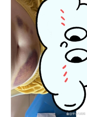 赤峰市婦產(chǎn)醫(yī)院抽血電話號(hào)碼-第1張圖片