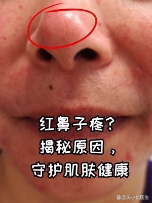 赤峰肌膚醫(yī)生加盟店電話號碼-第1張圖片