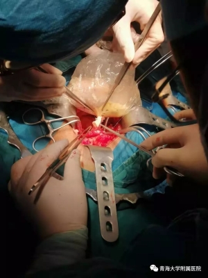 赤峰市腎移植醫(yī)院電話號(hào)碼-第1張圖片