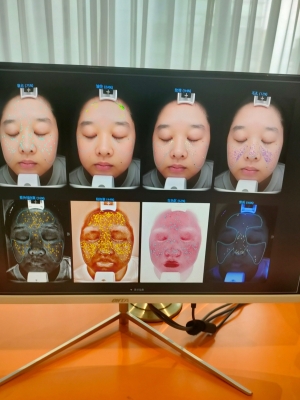 赤峰美容團(tuán)購水光針電話號碼-第1張圖片