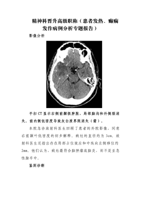 赤峰第二醫(yī)院癲癇科電話號碼-第1張圖片