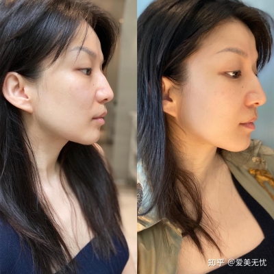 赤峰熱瑪吉團(tuán)購電話號碼-第1張圖片