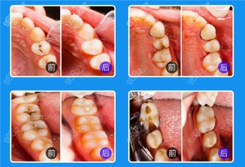 赤峰耳釘修復店地址電話號碼-第1張圖片